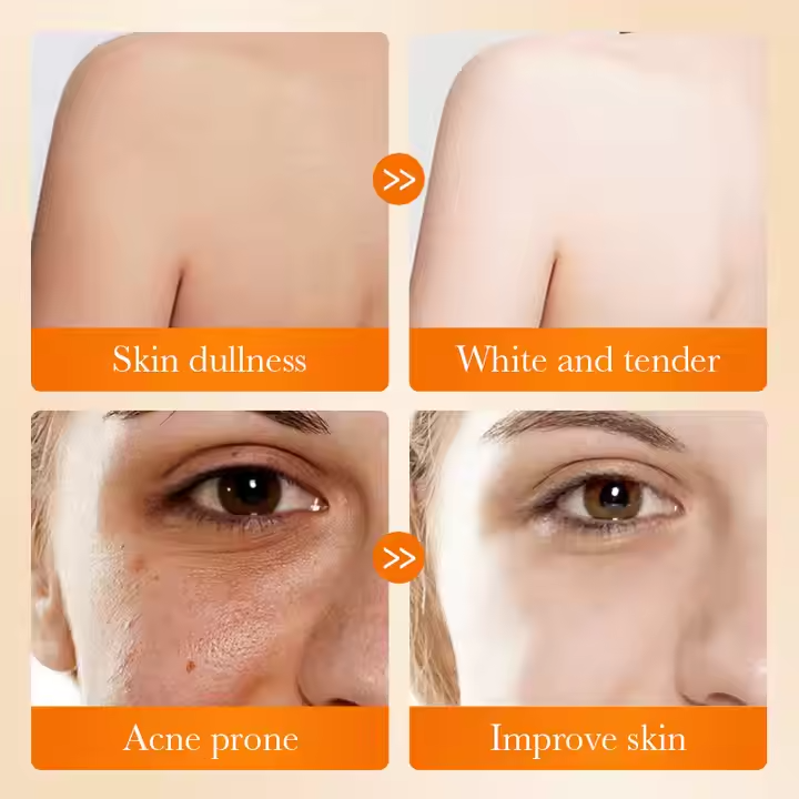 Kojic Acid Whitening Soap